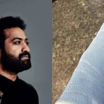 డ్రాగన్ సెట్స్‌లో ఎన్టీఆర్‌కు గాయం, 6-8 వారాల విశ్రాంతి తీసుకోవాలని సలహా: అధికారిక సమాచారం